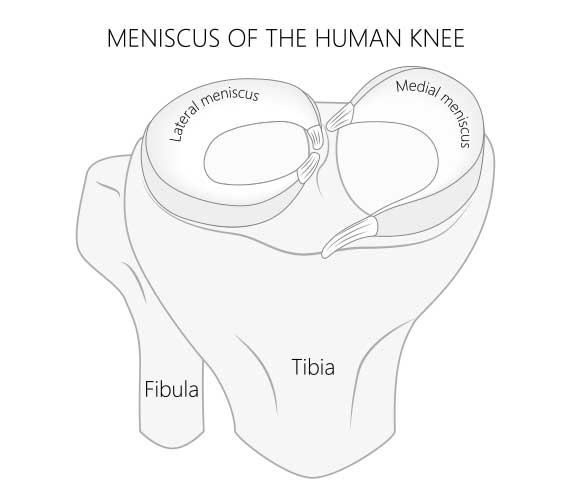 Best Brace For Meniscus Tear - WPH Physio